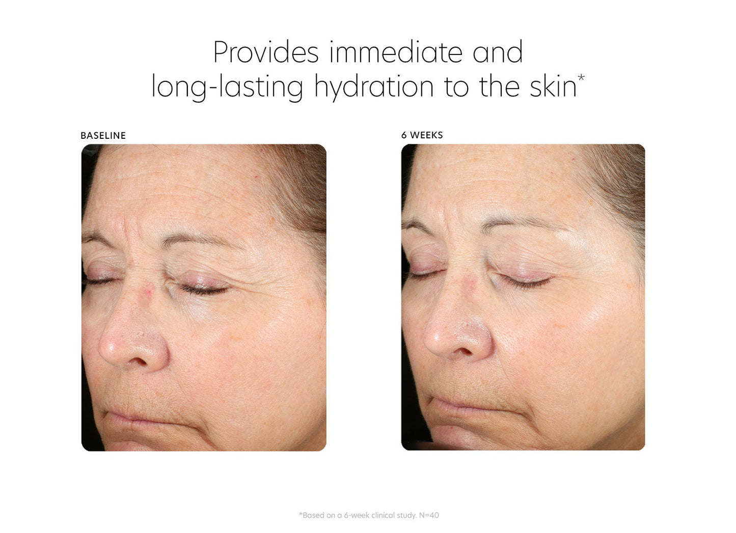 PCA Skin Hyaluronic Acid Boosting Serum